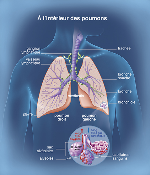 Cancer poumons 3 - A l'intérieur des pooumons